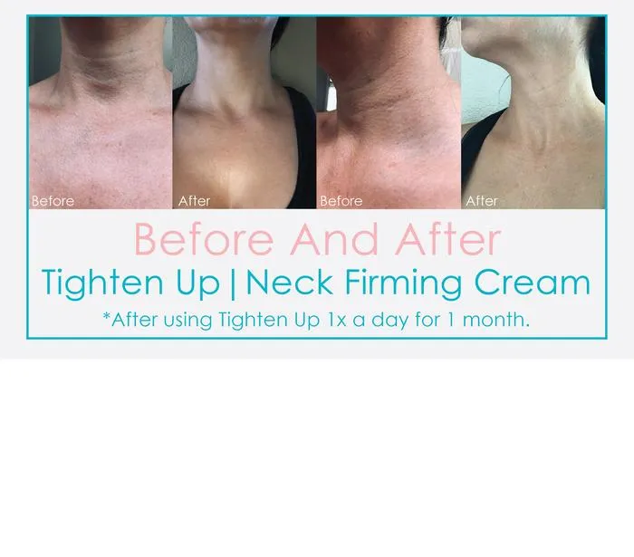 Epicuren Tighten Up Neck Firming Cream