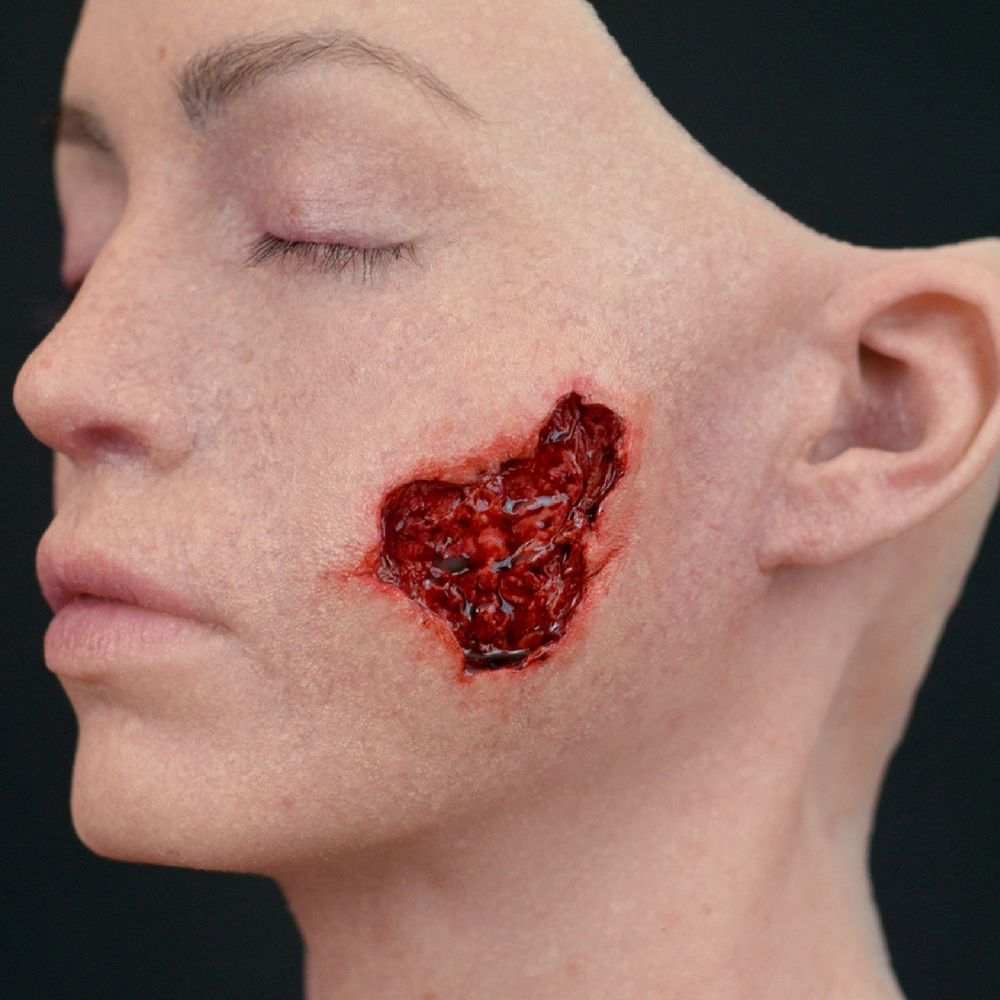 Out of Kit Exit Wound (Medium)