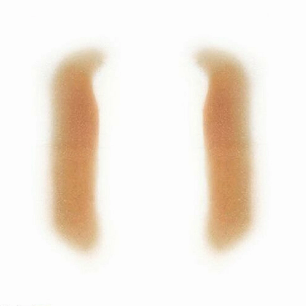 Out Of Kit Female Nasolabial Fold
