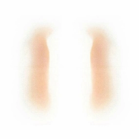 Out Of Kit Female Nasolabial Fold