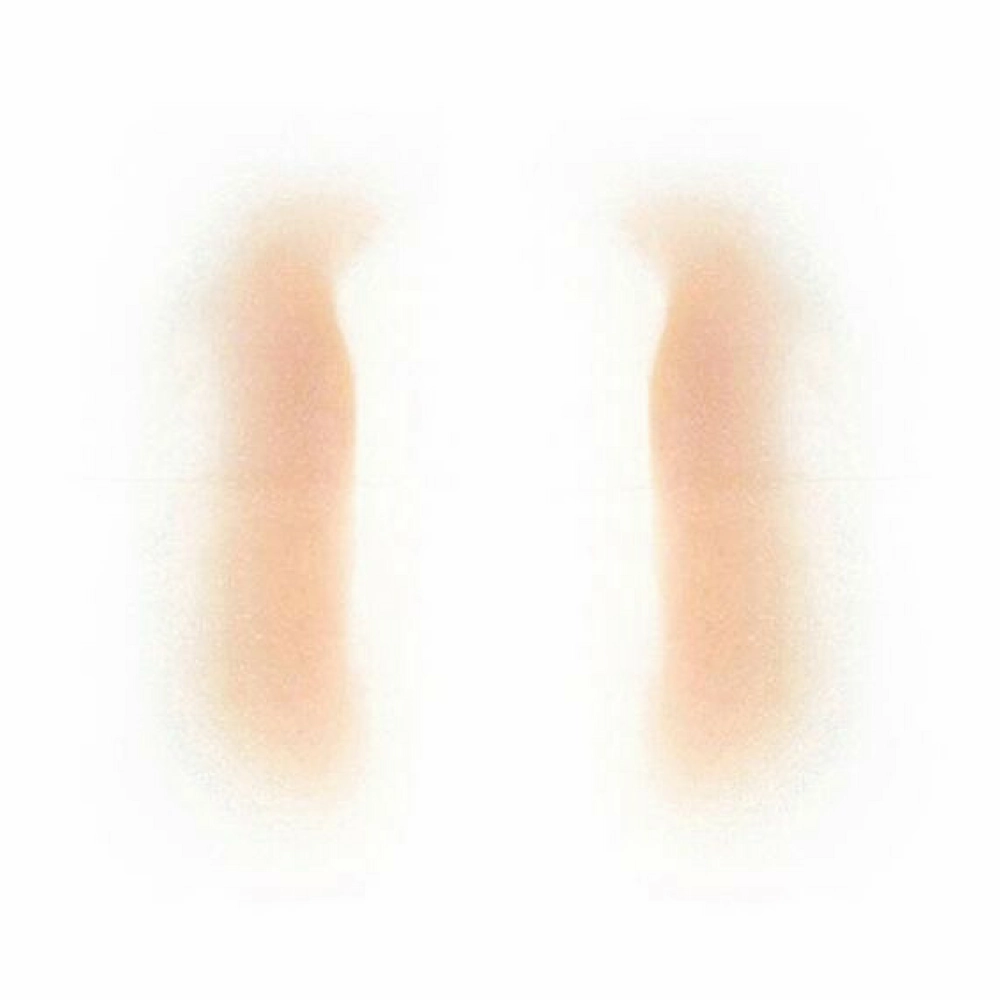 Out Of Kit Female Nasolabial Fold