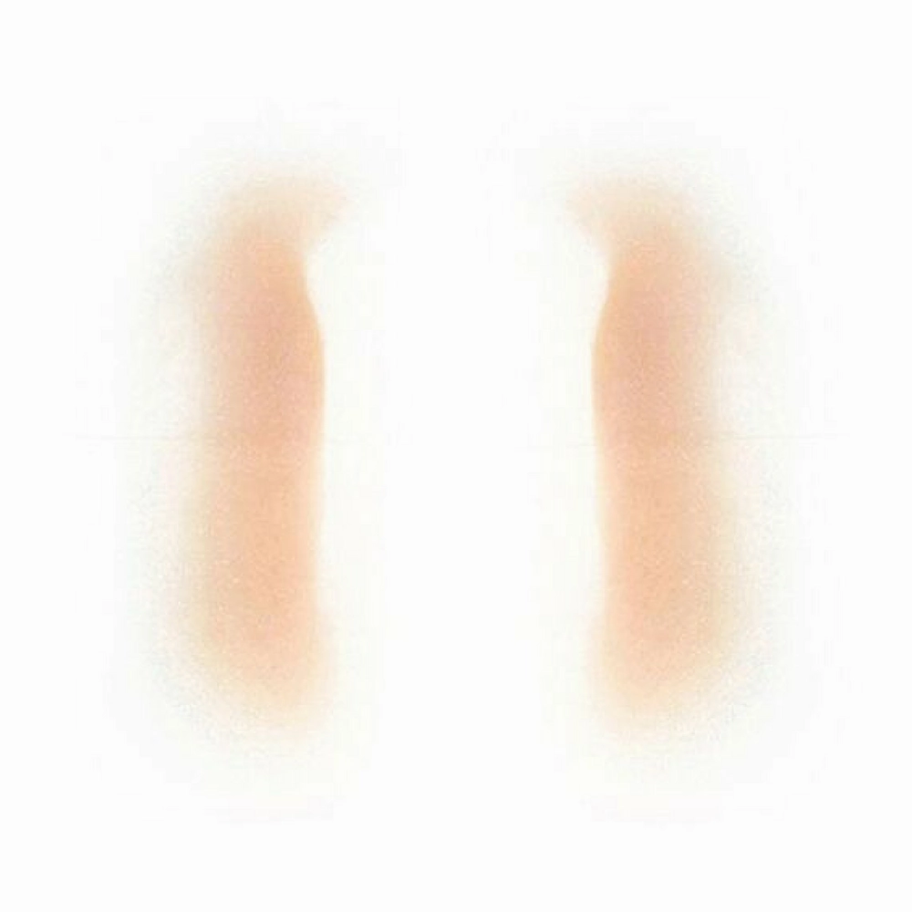 Out Of Kit Female Nasolabial Fold