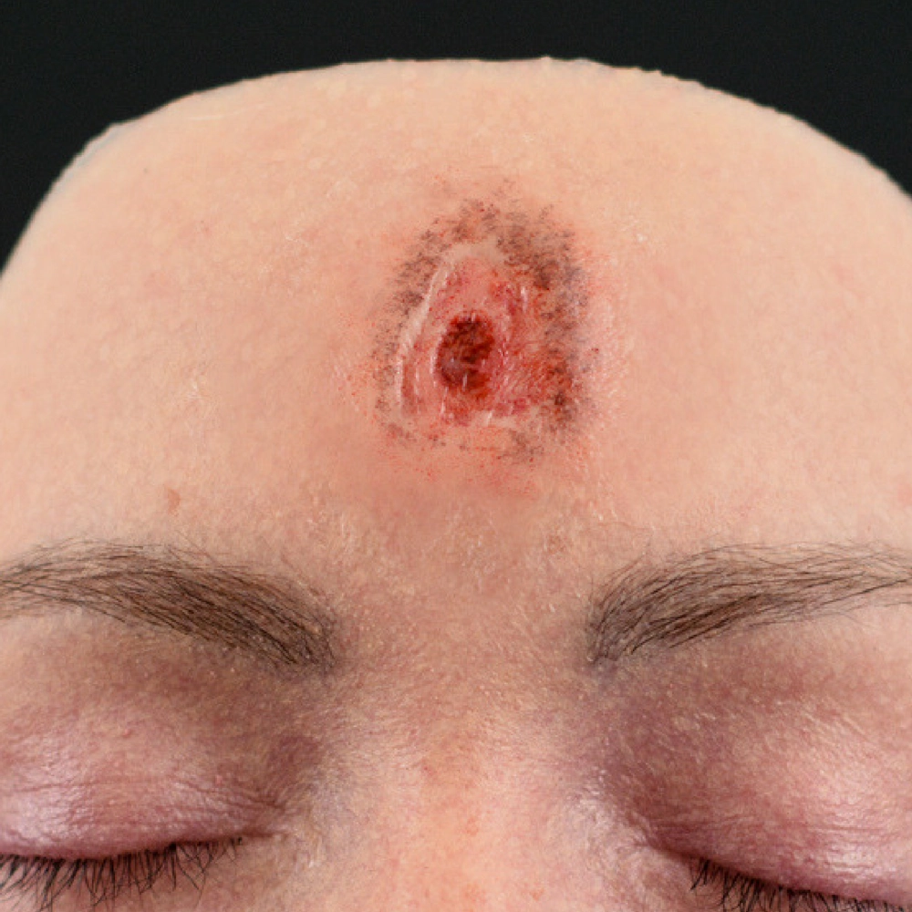 Out of Kit Point Blank Bullet Hole