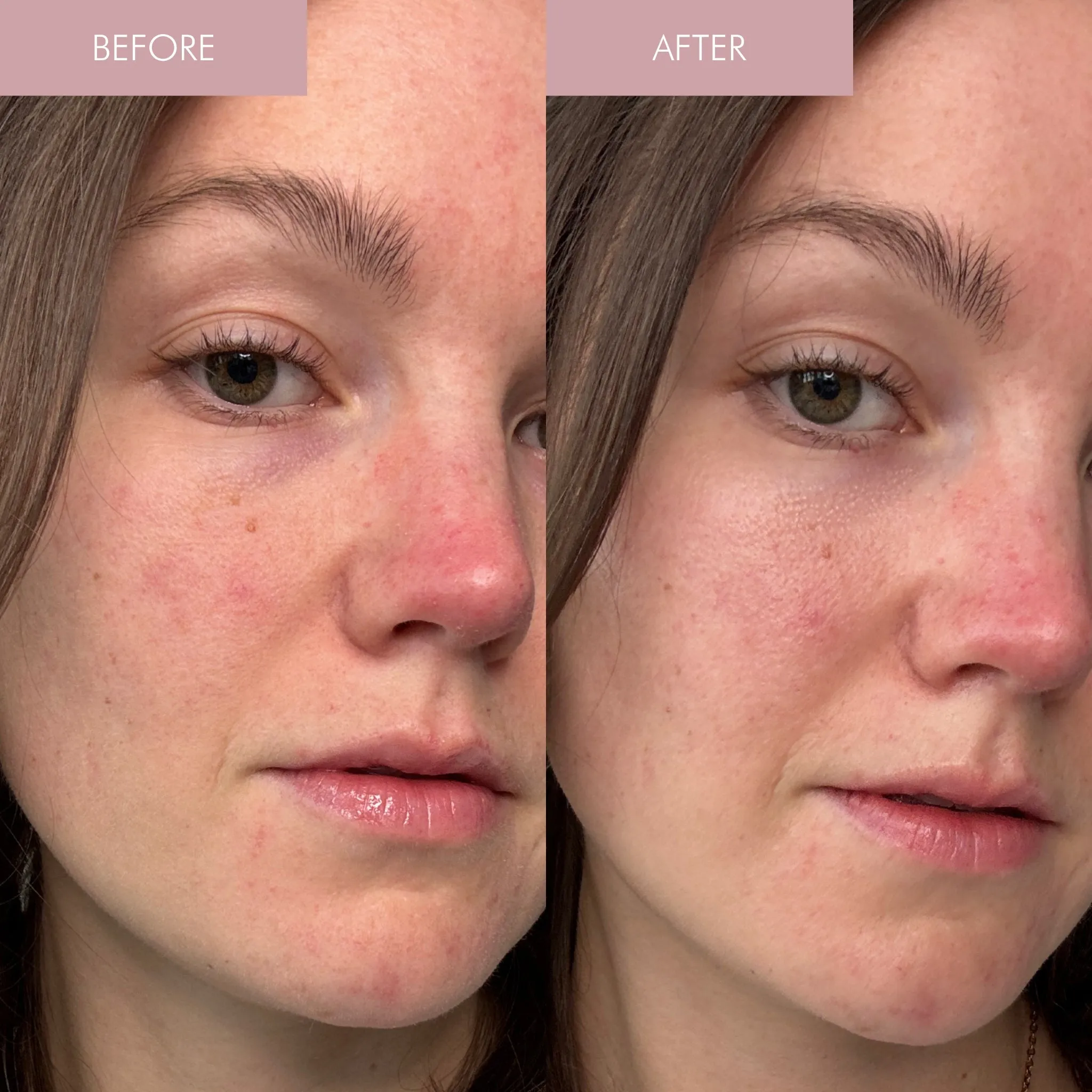 Pearl Peptide Glaze Facial Essence