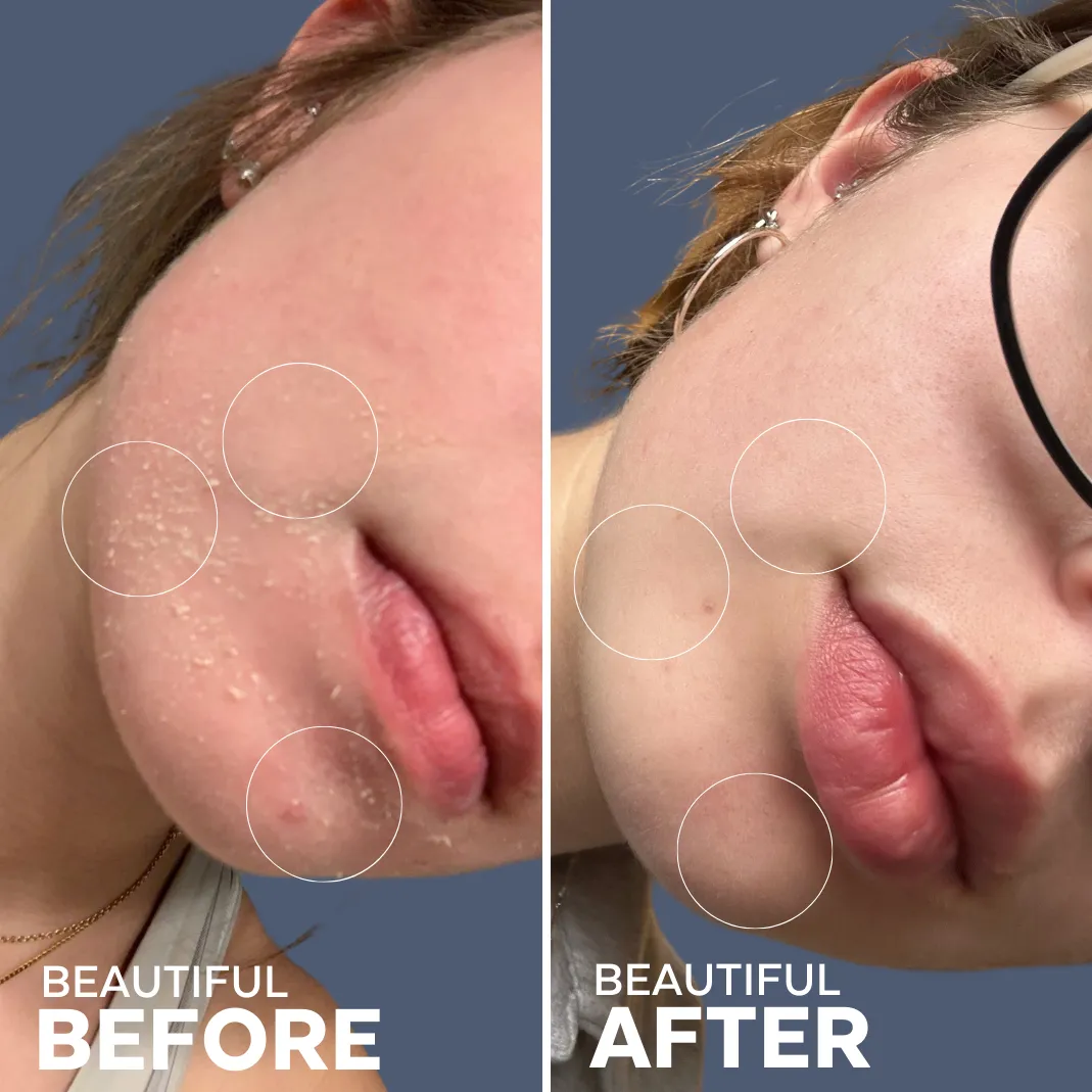 Skin Hero Bakuchiol   Calendula Serum