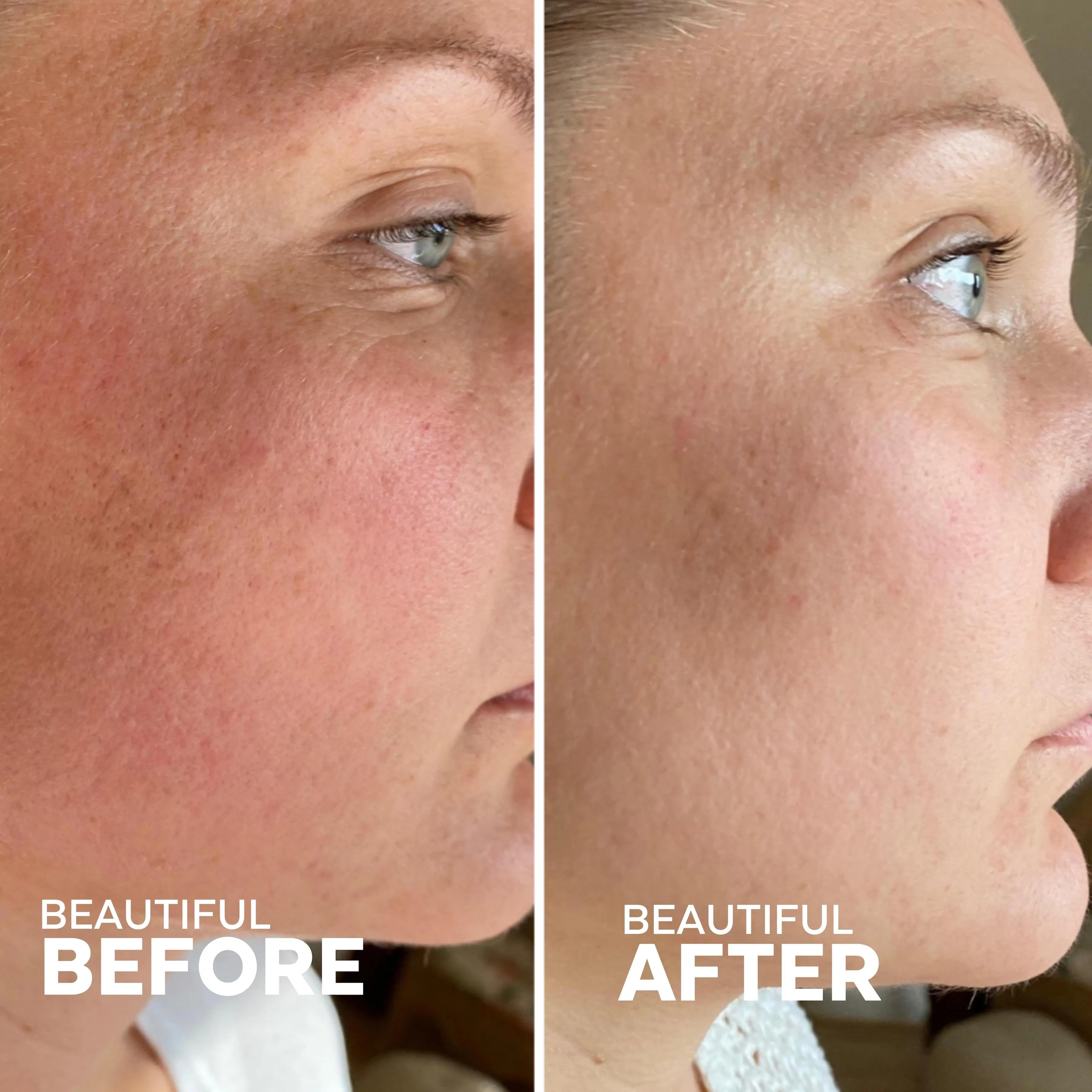 Skin Hero Bakuchiol   Calendula Serum