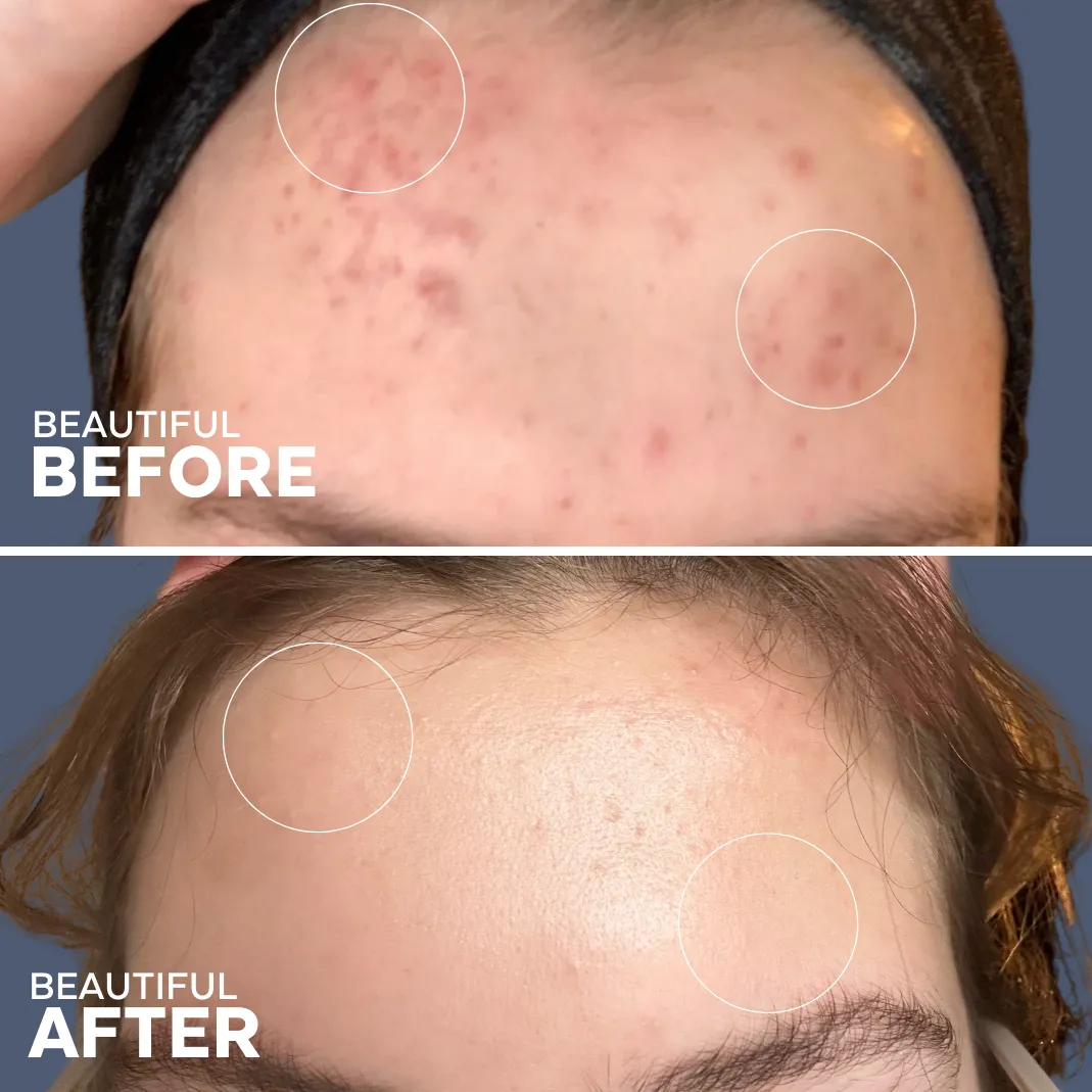 Skin Hero Bakuchiol   Calendula Serum