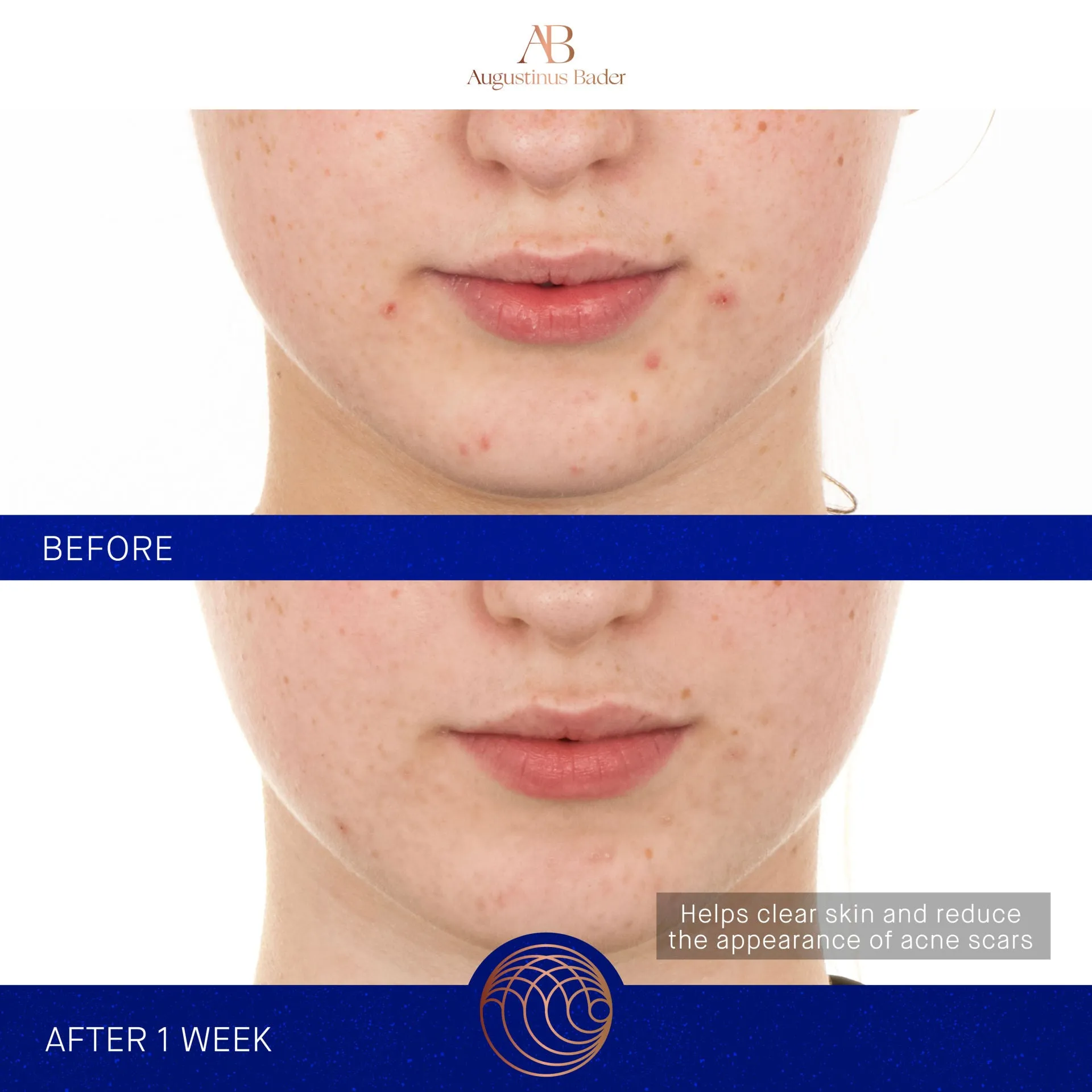 The Retinol Serum