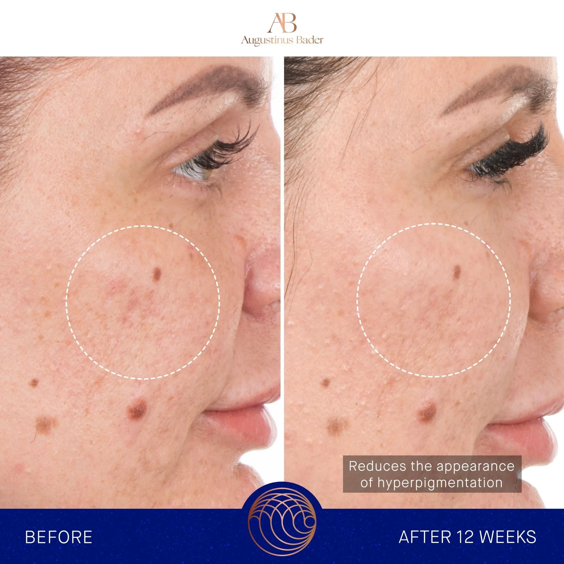 The Retinol Serum